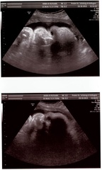 Ultrasound 28Oct2013